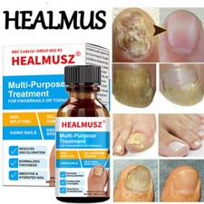 Nail Repair Serum Fungal Nail Treatment Liquid Remove Toe Nail Fungus Essence