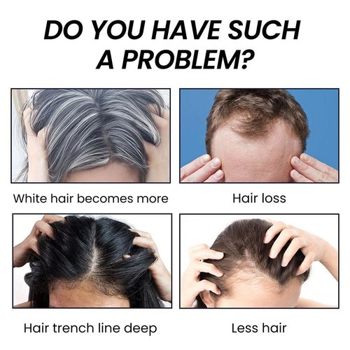 Barra inversa para cabello gris, champú barra inversa para cabello gris 60 g - Imagen 9 de 13