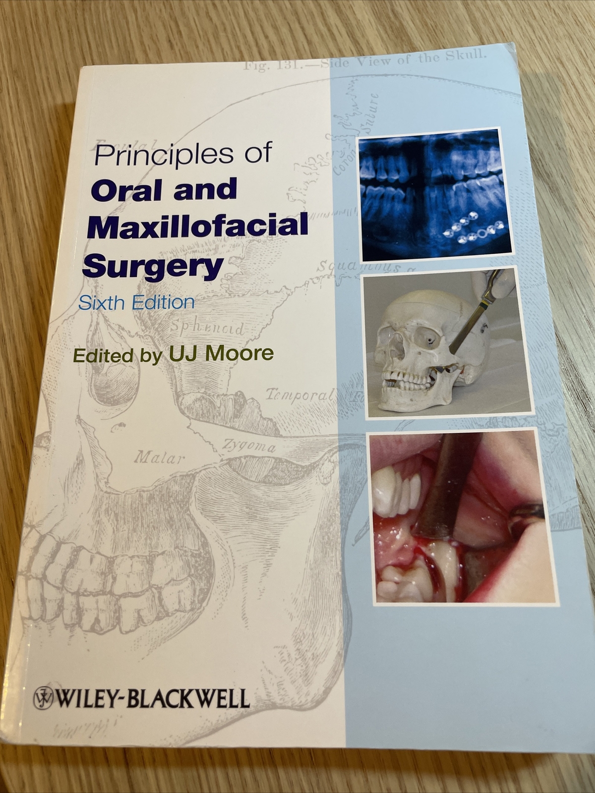 Principles of Oral and Maxillofacial Surgery by U. J. Moore (Paperback, 2011)