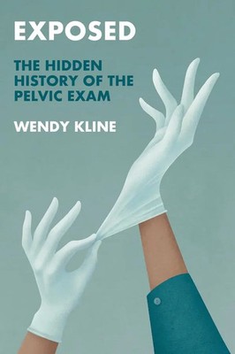 Exposed | The Hidden History of the Pelvic Exam | Wendy Kline | Englisch | Buch