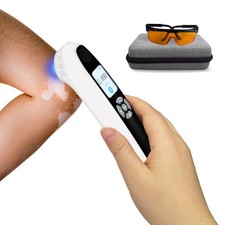 Handheld Home Use 308nm UVB Light Phototherapy Device 6 Diodes for Skin Dieases