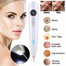 Anti-Aging Laser Plasma Pen Mole Removal Dark Spot Skin Tag Tattoo Wart Remover