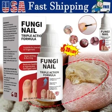 Fungi-Nail Anti-Fungal Liquid Solution KillsFungus That Can Lead To Nail HOT US~