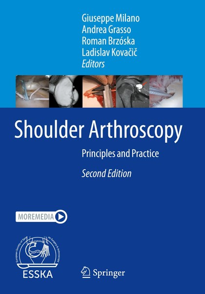 Giuseppe Milano (U. A.) | Shoulder Arthroscopy | Taschenbuch | Englisch (2024)-image