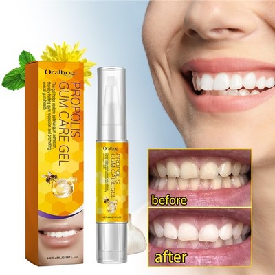 Propolis Gum Care l Oral Care Cleaning Repair Teeth Yellow Teeth