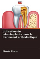 Eduardo ÁLvarez | Utilisation De Microimplants Dans Le Traitement Orthodontique