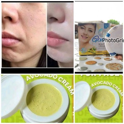 Avocado Cream for Pekas Melasma,dark spot