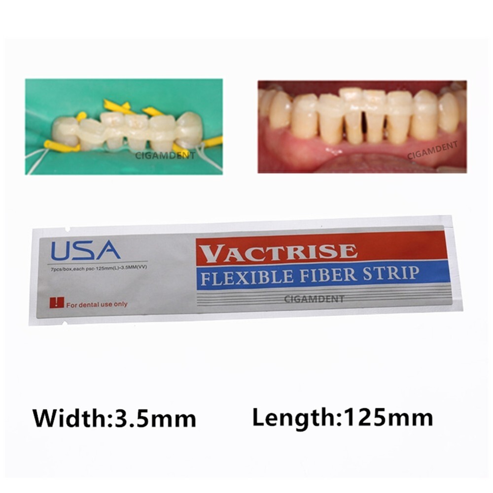 1Box Dental Glass Fiber Splint Light Cure Composite Resin Bonding Strip