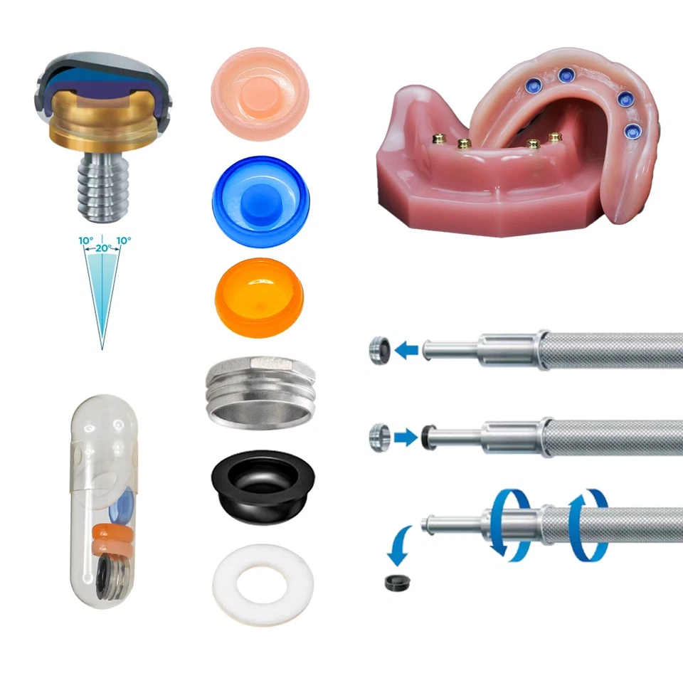 Insertos de tapa masculina localizador de retención de implantes de pilar de sobredentadura dental 20 un. Foto 3 de 4