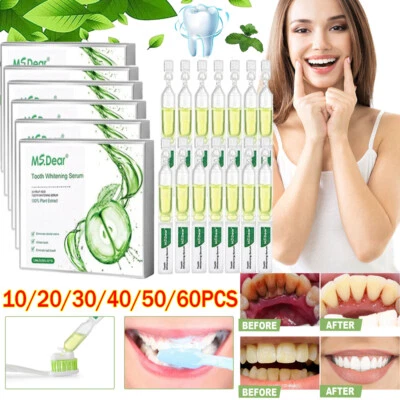 MS.DEAR 60-10X Ampoule Toothpaste, Ampoule Tooth Serum, Ampoule Essence Toothpaste