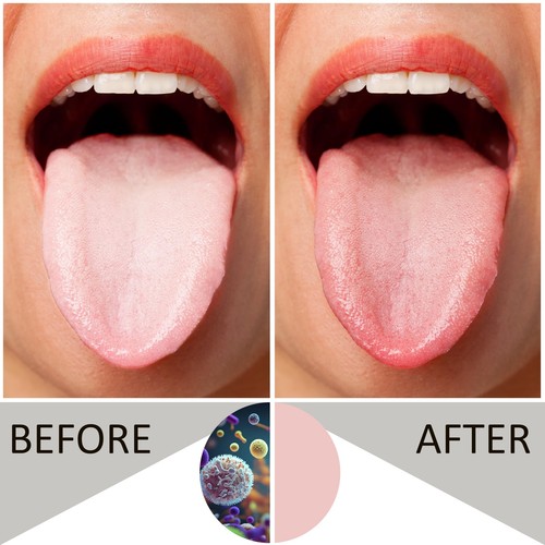 Stainless Steel Tongue Scraper for Fresh Breath & Oral Health | 2 Pack - Picture 8 of 8