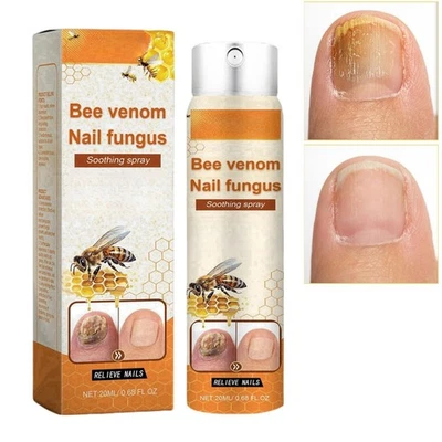 SHENGQIU Bee Venom Nail Soothing Spray for Toenail,Bee Venom Nail Fungus Soothing Spray,N