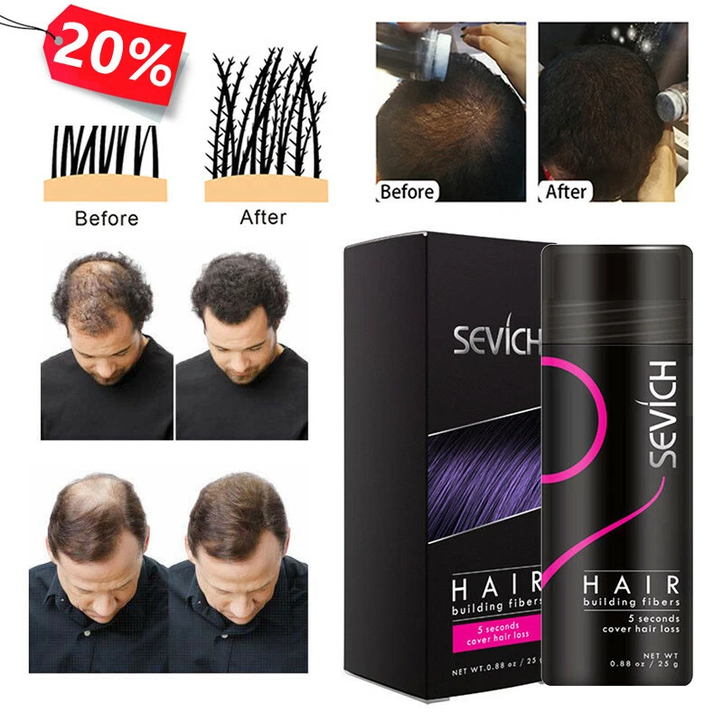 Discover 162+ hair building fibers side effects latest camera.edu.vn