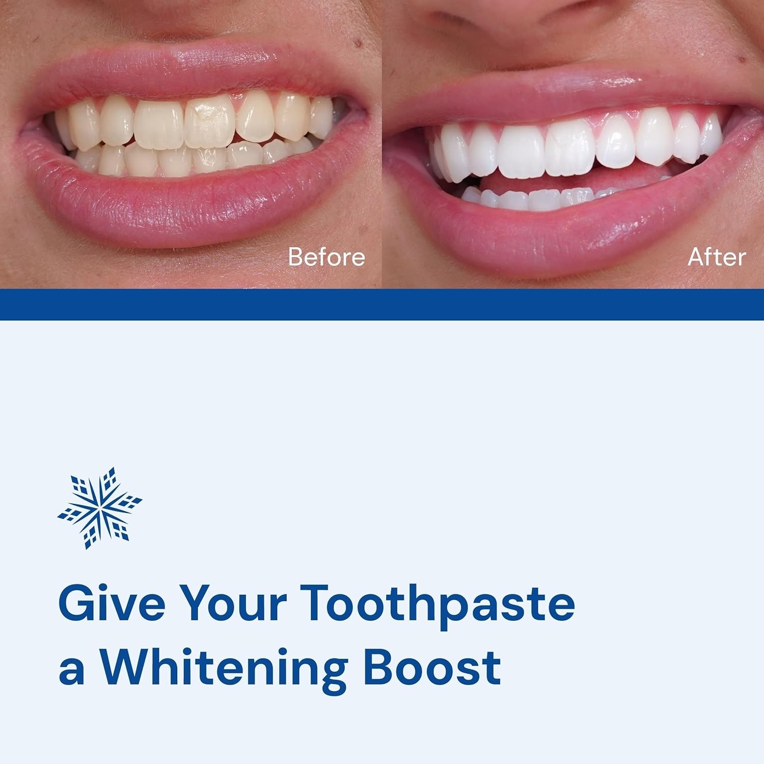 Snow Magic Teeth Whitening Powder with Hydroxyapatite &ndash; Tooth Polisher for Sensi