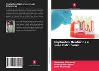 Implantes DentáRios E Suas Estruturas Amit Bhardwaj
