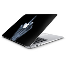 Skin Decal Wrap for Macbook Air 13 Inch 13" - hand sign x-ray 1