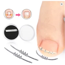 Ingrown Toenail Correction Tool Pedicure Straightening Clamp for Toes