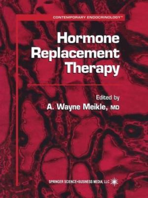 Hormone Replacement Therapy (Contemporary Endocrinology) -