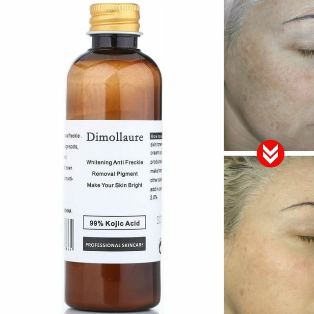 dimollaure whitening cream