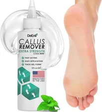 DeEnti Callus Remover for Feet, Extra Strength Foot Gel, Clear 