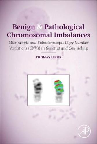 Benign and Pathological Chromosomal Imbalances Liehr Hardback Academic Press