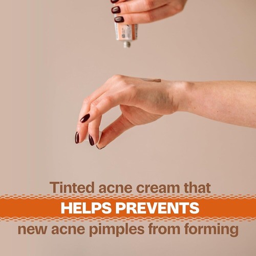 Original Acnomel Adult Acne Cream 1.3oz NEW LOOK ARRIVING - Picture 5 of 5