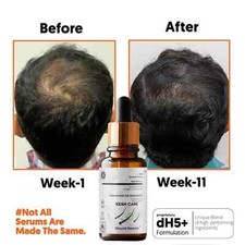 2X Hair ReGrowth Serum Hair Growth Serum Designed for Thinning Hair  Hair Loss