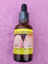 Cura Hongos Natural Antifungal  drops