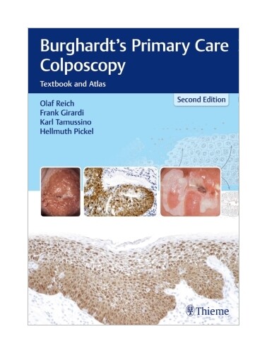 Thumbnail - Burghardt's Primary Care Colposcopy