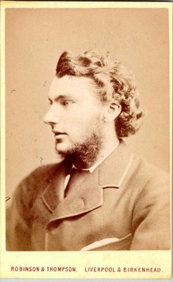Young Man w/ Unruly Hair, Chin Beard, c1880, CDV Photo, #4604
