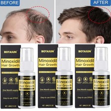 3 Pack 5 Minoxidil Hair Growth Serum Spray for Men Hair Regrowth 3 Month Supply