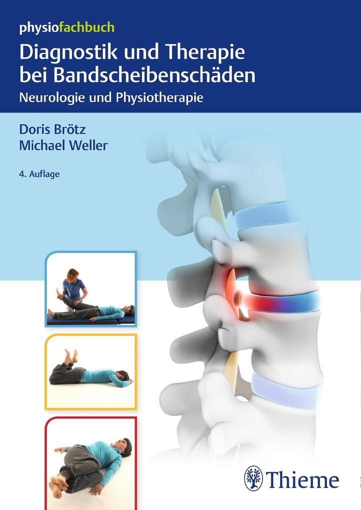 Thumbnail - Diagnostik Und Therapie Bei Bandscheibenschäden | Doris Brötz, Michael