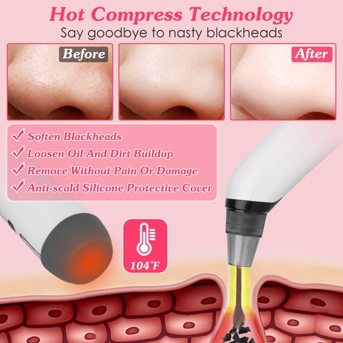 Hot Compress Electric Blackhead Remover with 4 Probes 4 Pimple Popper Tools - Picture 5 of 15