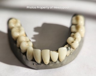 Antique Vintage 1800's Lead False Teeth Dentures Partial Lowers Medical Scrap