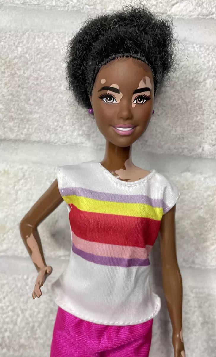Barbie doll vitiligo new arrivals