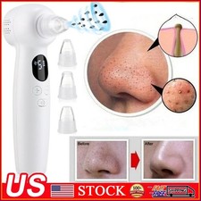 Electric Blackhead Remover Pore Nose Sucker Pimple Skin Acne Face Cleaner Vacuum