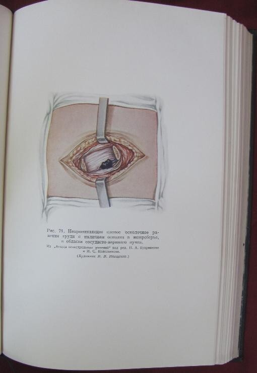 Picture 9 of 24
