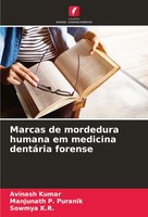 Marcas De Mordedura Humana Em Medicina DentáRia Forense Avinash Kumar (U. A.)