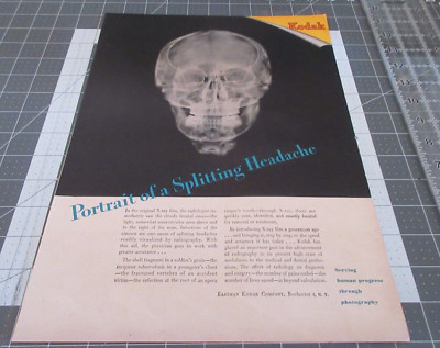 1946 Kodak, Portrait of a Splitting Headache, Vintage Print Ad
