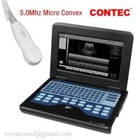 CMS600P2 Portable Ultrasound Scanner Laptop Machine+Cardiac Probe Micro convex