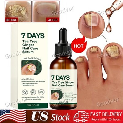 7 Days Tea Tree & Ginger Nail Care Serum 30ml For Repair Dry Brittle Nails US