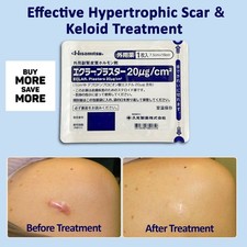 Authentic Eclar Plaster Keloid/Hypertrophic Scar Treatment,  Keloid Removal Tape