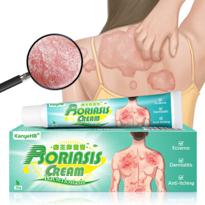 Antibakterielle Creme 20g Natürliche Kräuter Hautpflege Anti Juckreiz Salbe