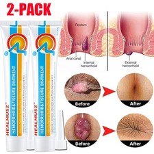 2X Hemorrhoid Cream Haemorrhoids Anal Fissure Prolapse Hemorrhoid Gel Pain Piles