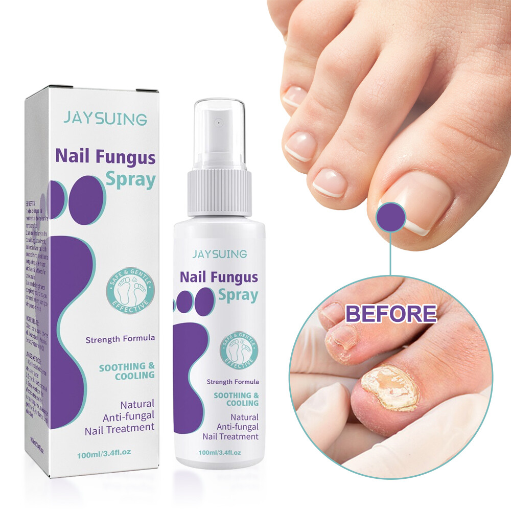 3X Medinail Fungus Spray 100ml,Toenail Fungus Treatment,Nail Fungus