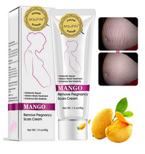 Mango Stretch Marks and Scar Cream, Stretch Mark and Scar Removal Cream for Preg