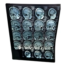 21 Brain Scans MRI Films - Real Official Each Different w/ Sleeve