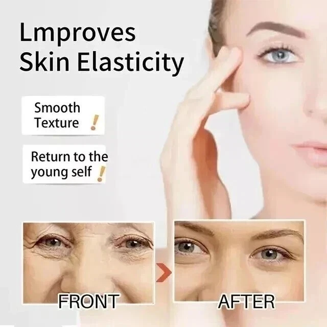 AHA Strong Brightening Body Cream Hydroxy Acid Vitamin C Whitening Serum 30ml - Image 2 of 4