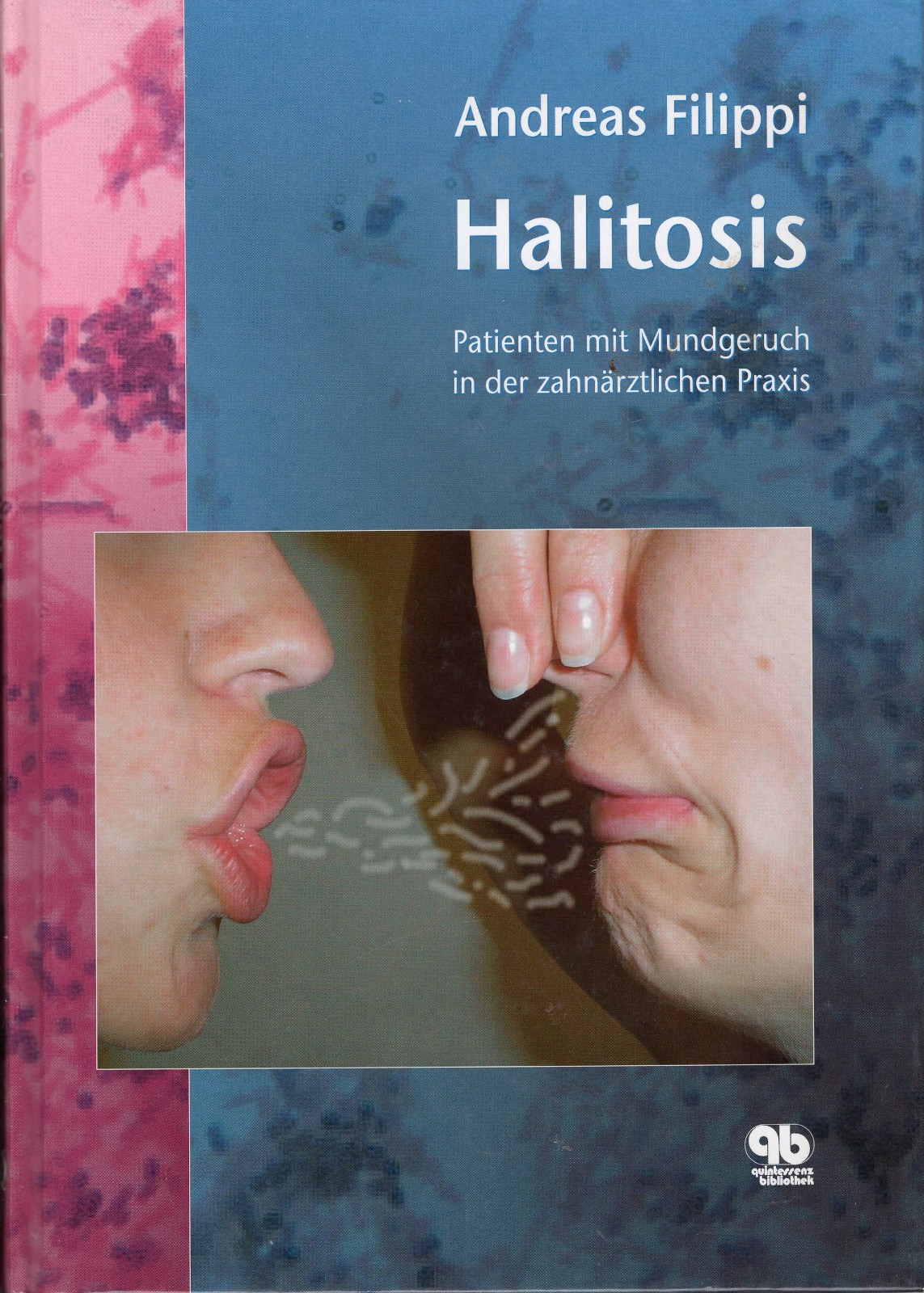 Halitosis - Patienten mit Mundgeruch in der zahnärztlichen Praxis | sehr gut