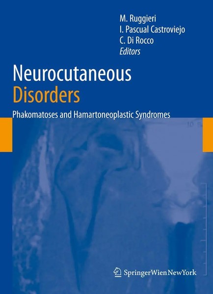 Martino Ruggieri (U. A.) | Neurocutaneous Disorders | Taschenbuch | Englisch-image
